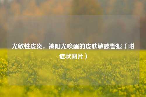 光敏性皮炎,被阳光唤醒的皮肤敏感警报(附症状图片)